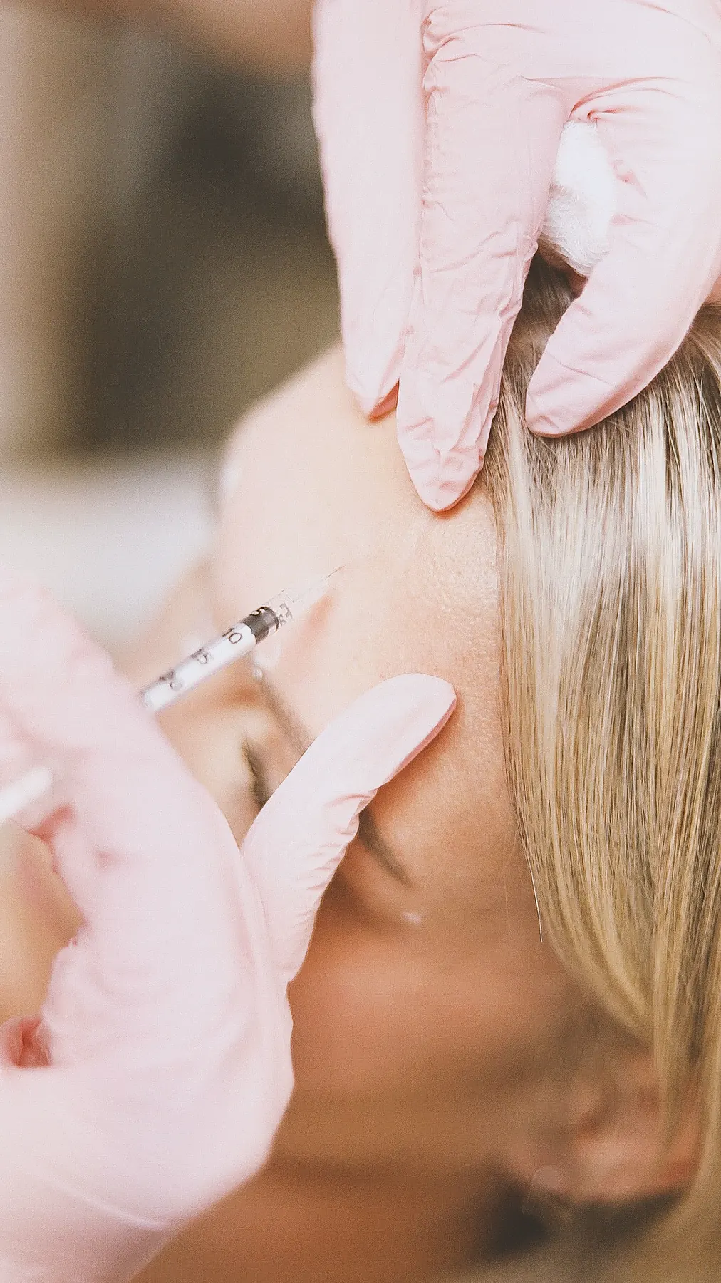 Forehead filler treatment detail at Elite Smiles