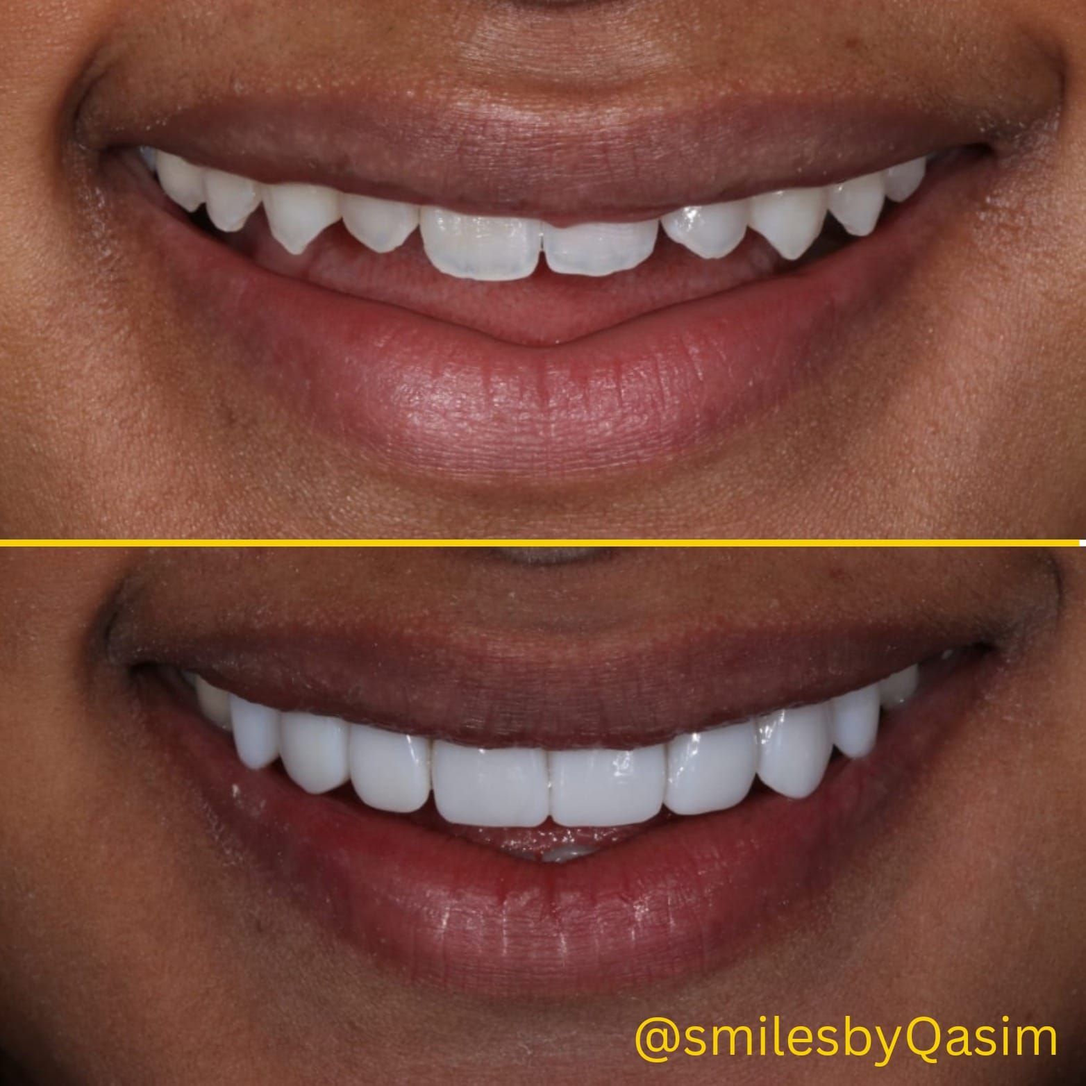Smile makeover case image 5