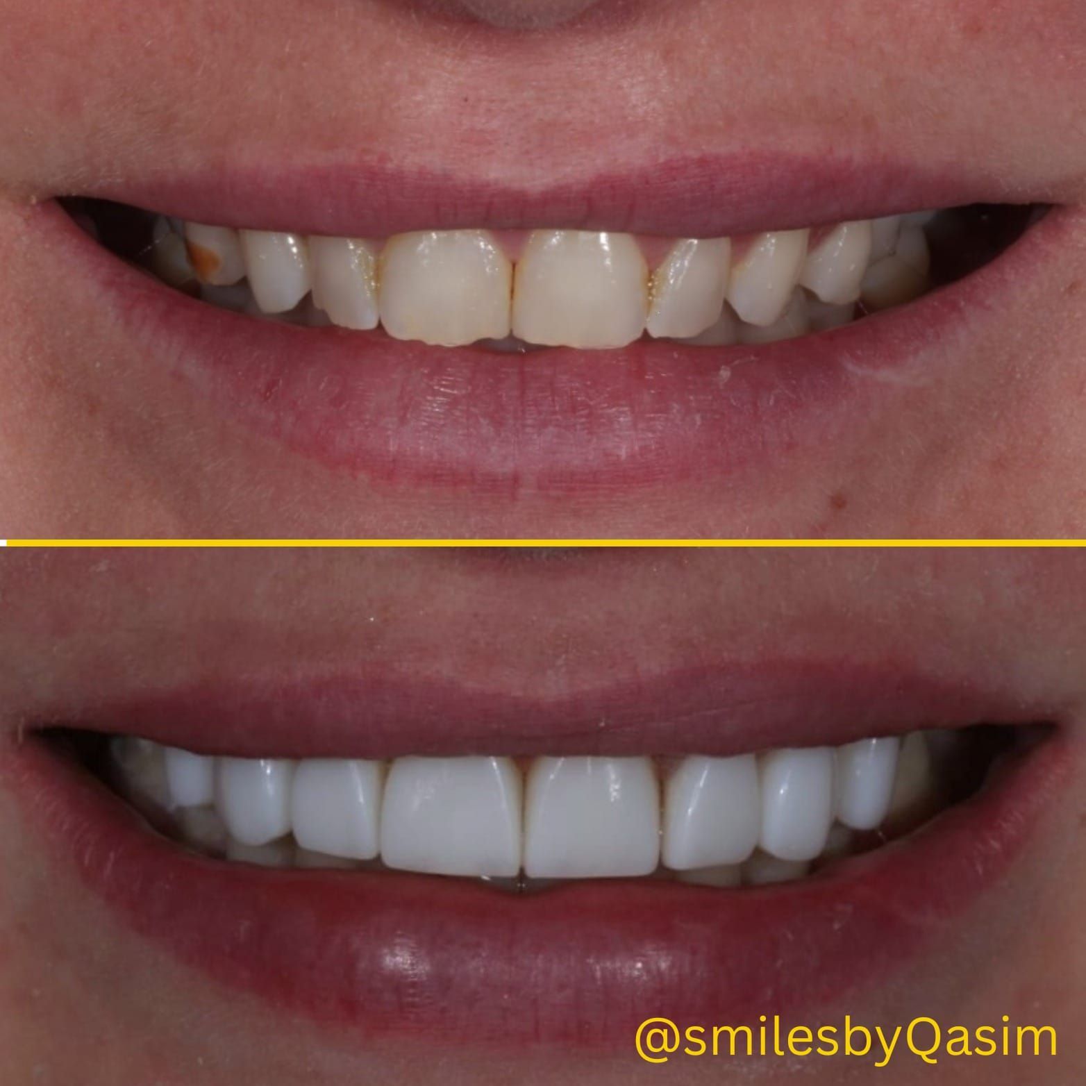 Smile makeover case image 4
