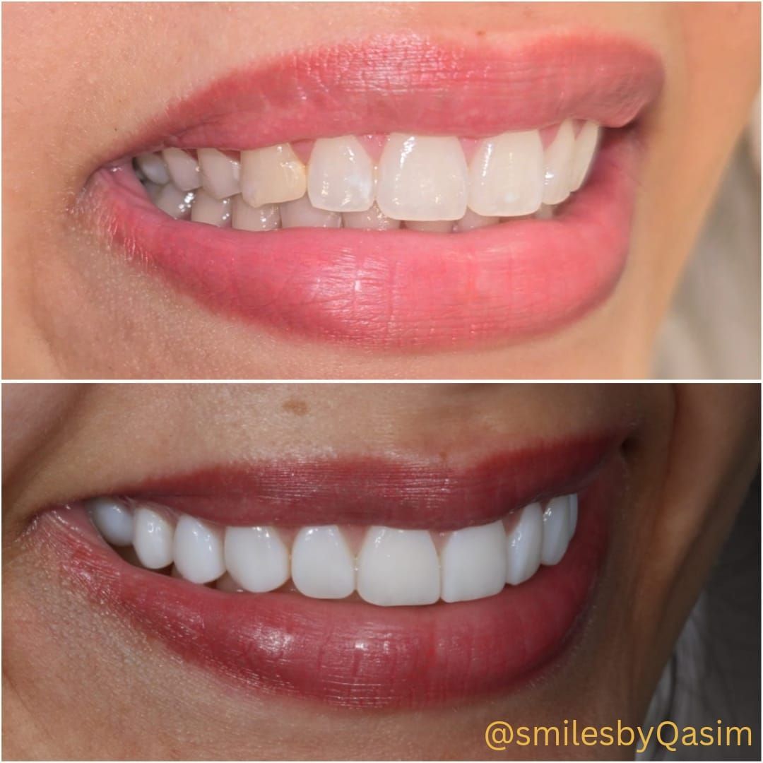 Smile makeover case image 3