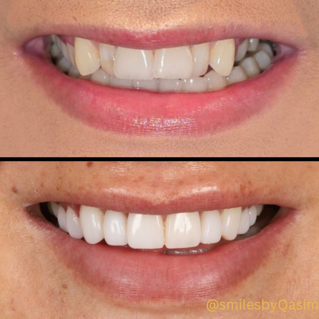 Smile makeover case image 1
