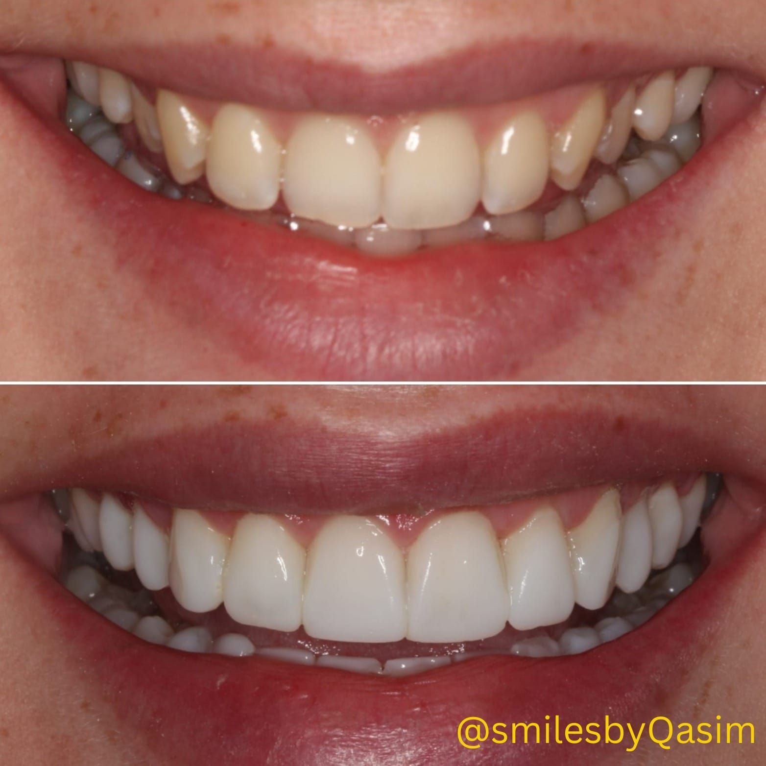 Smile makeover case image 6