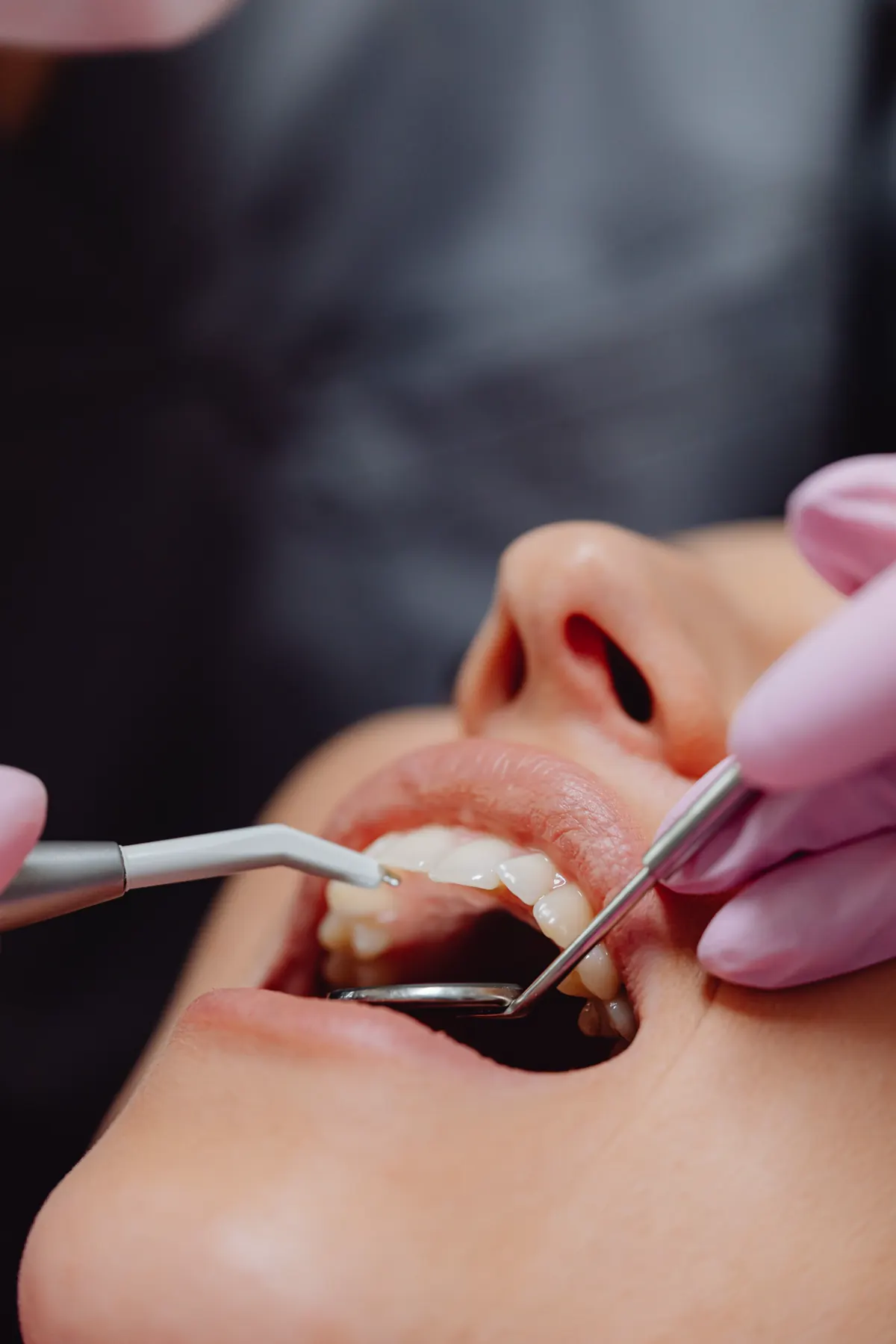 Dental examination at Elite Smiles